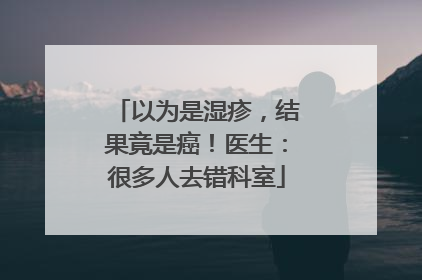 以为是湿疹，结果竟是癌！医生：很多人去错科室